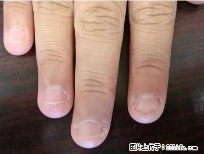 剪指甲、挖耳屎，这些日常小动作竟隐藏大危害！ - 兴安盟生活资讯 - 兴安盟28生活网 xam.28life.net